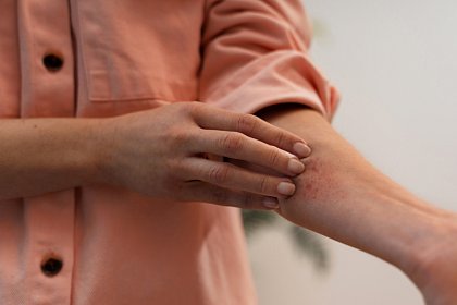 Что делать, если постоянно чешется кожа?